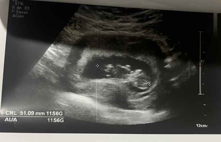 Future mamme Giugno/Luglio 2025 ❤️ - 1