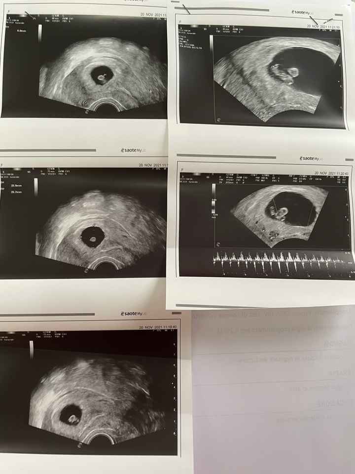 🍀Future mamme Luglio 2022🍀 - 1