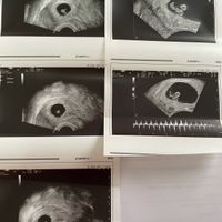 🍀Future mamme Luglio 2022🍀 - 1