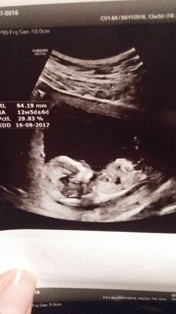 Mamme agosto 2017 - 2
