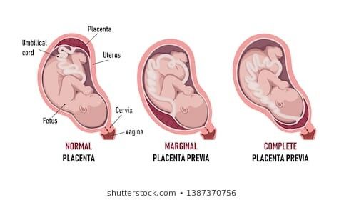 Premorfologica...e placenta 1