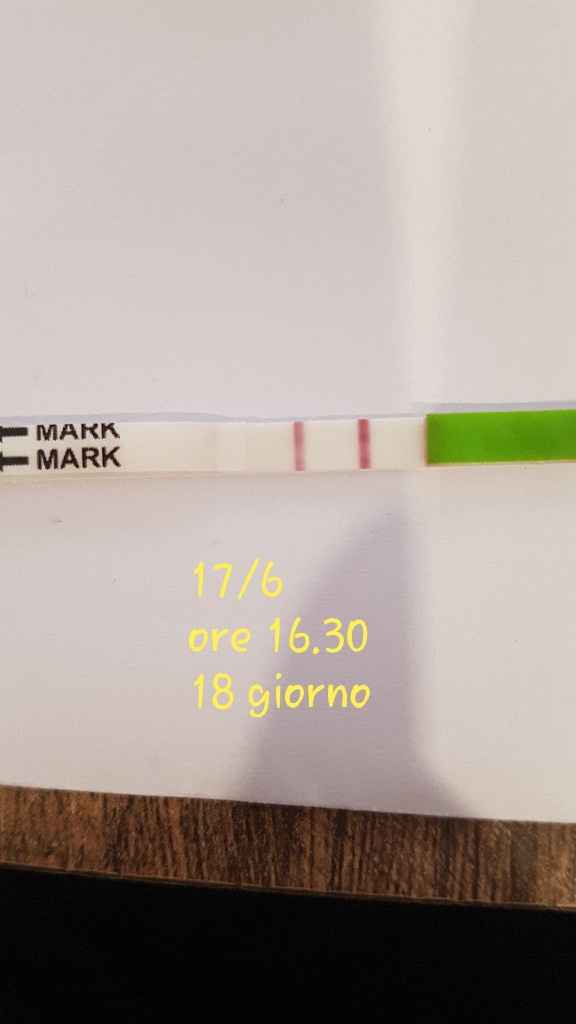 Analisi muco cervicale esperte venite a me! - 2