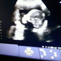 Baretto, ovvero chiacchere da mamme - 1