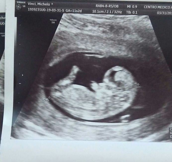 x me è maschietto 1