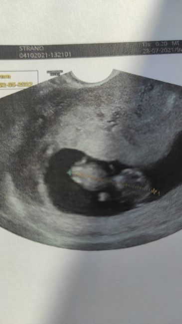 💙💜future mamme di Maggio 2022💙💜 3