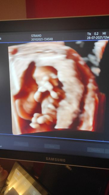 💙💜future mamme di Maggio 2022💙💜 2