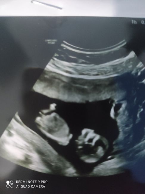 💙💜future mamme di Maggio 2022💙💜 3