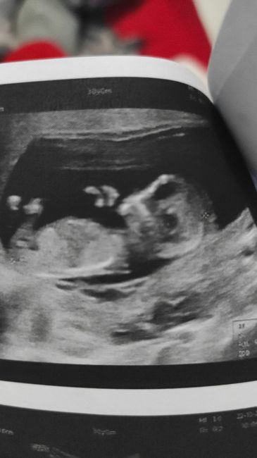 💙💜future mamme di Maggio 2022💙💜 - 1