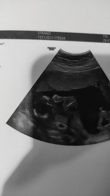 💙💜future mamme di Maggio 2022💙💜 1
