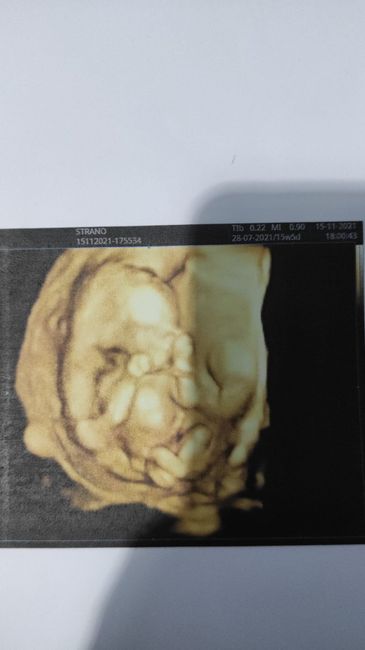 💙💜future mamme di Maggio 2022💙💜 1