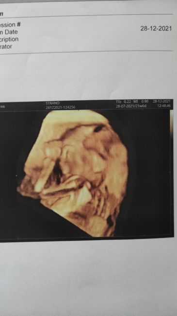 💙💜future mamme di Maggio 2022💙💜 3