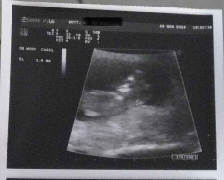 Ecco il nostro ❤️ - 1