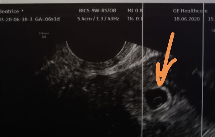 Future Mamme Febbraio 2021 - 1