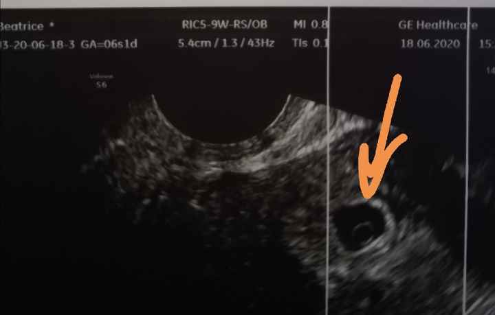 Future Mamme Febbraio 2021 - 1