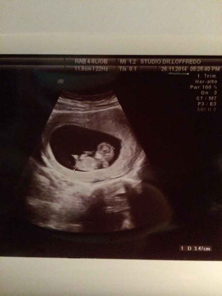 3,5 cm di amore immenso  - 1