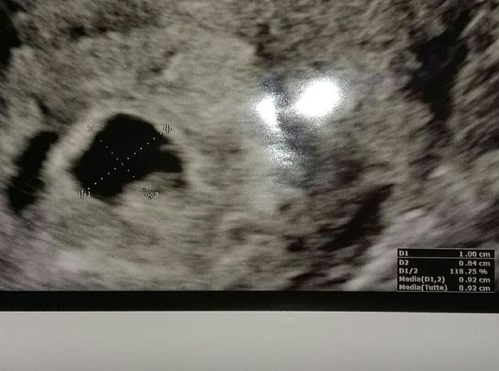 Mamma Marzo 2020.... - 1