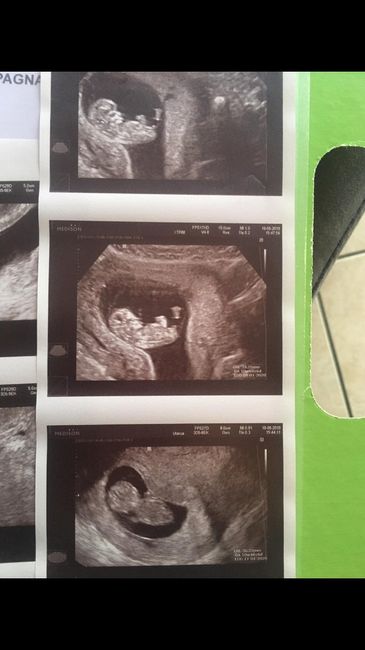 Metodo Ramzi... chi mi aiuta?! - 1