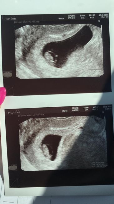 Metodo Ramzi... chi mi aiuta?! - 1