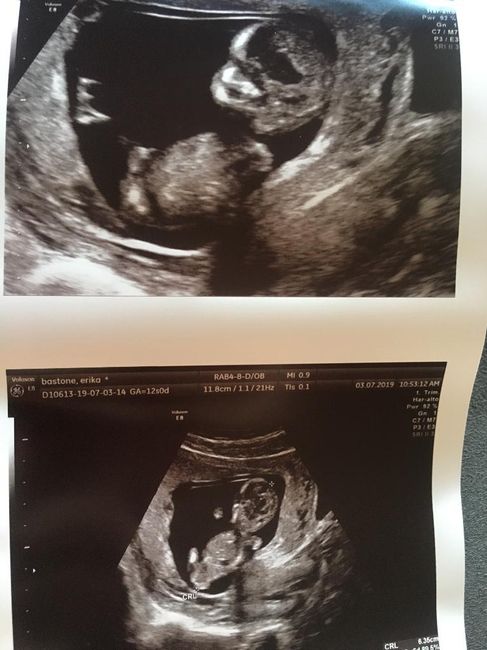 Metodo Ramzi... chi mi aiuta?! - 1