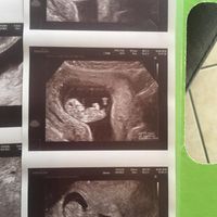 Metodo Ramzi... chi mi aiuta?! - 1