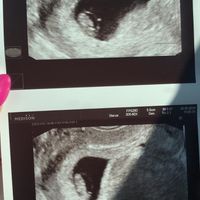 Metodo Ramzi... chi mi aiuta?! - 1