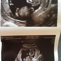 Metodo Ramzi... chi mi aiuta?! - 1