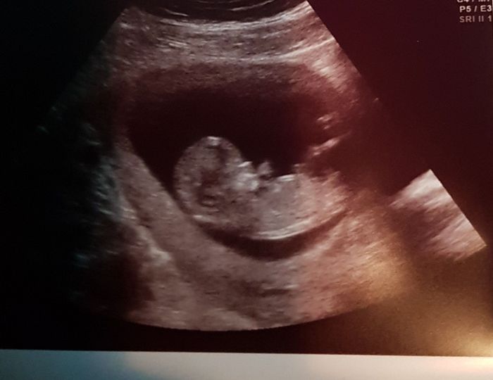 Future mamme novembre 2020 🌞🍁🌷♾ - 1