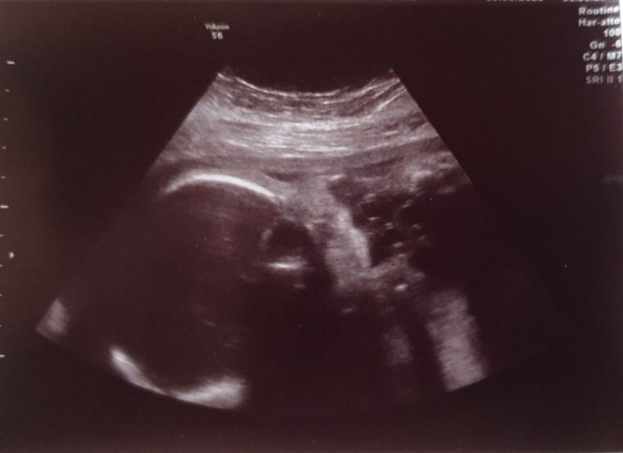 Future mamme novembre 2020 🌞🍁🌷♾ - 1