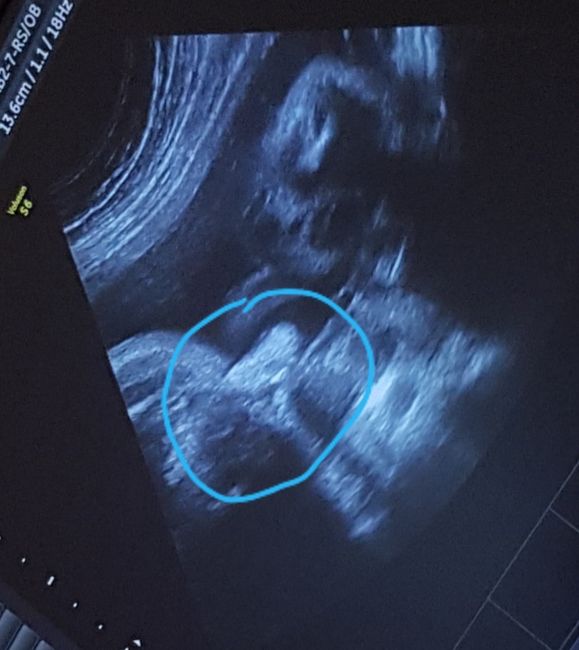 Future mamme novembre 2020 🌞🍁🌷♾ - 1