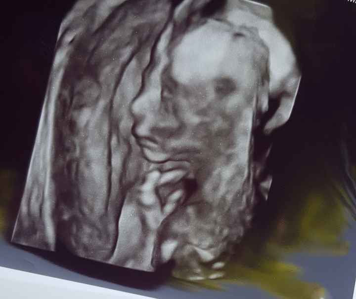 Future mamme novembre 2020 🌞🍁🌷♾ - 1