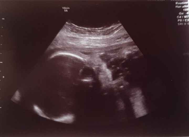 Future mamme novembre 2020 🌞🍁🌷♾ - 1