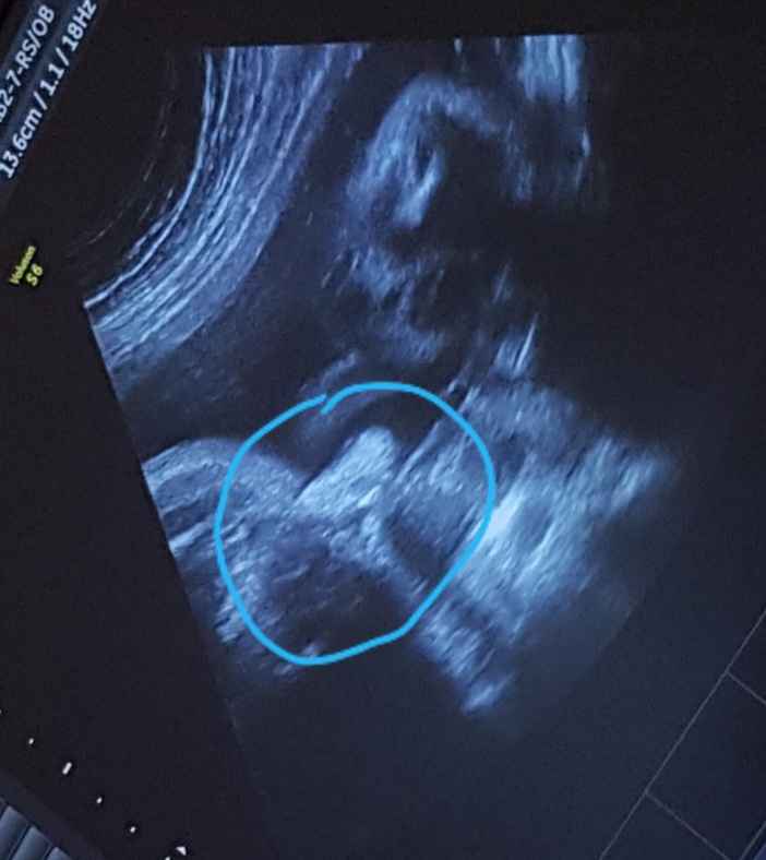 Future mamme novembre 2020 🌞🍁🌷♾ - 1