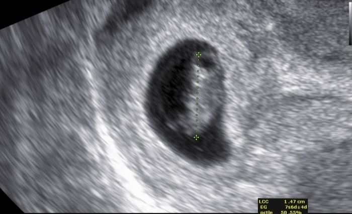 Future Mamme Febbraio 2021 - 1