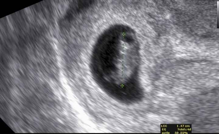 Future Mamme Febbraio 2021 - 1