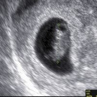 Future Mamme Febbraio 2021 - 1