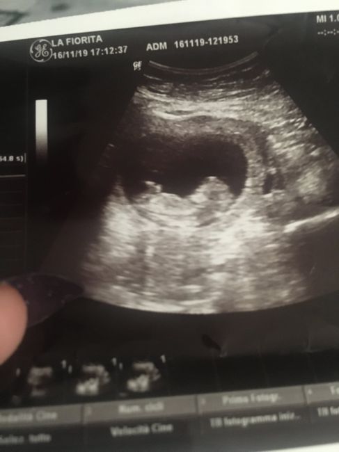 Esperte Nub Theory - 1