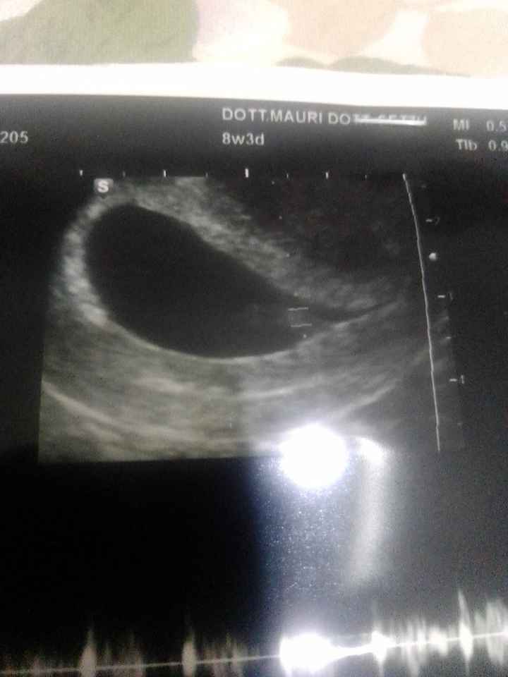 Future Mamme Dicembre 2020 ❤️😍 - 1