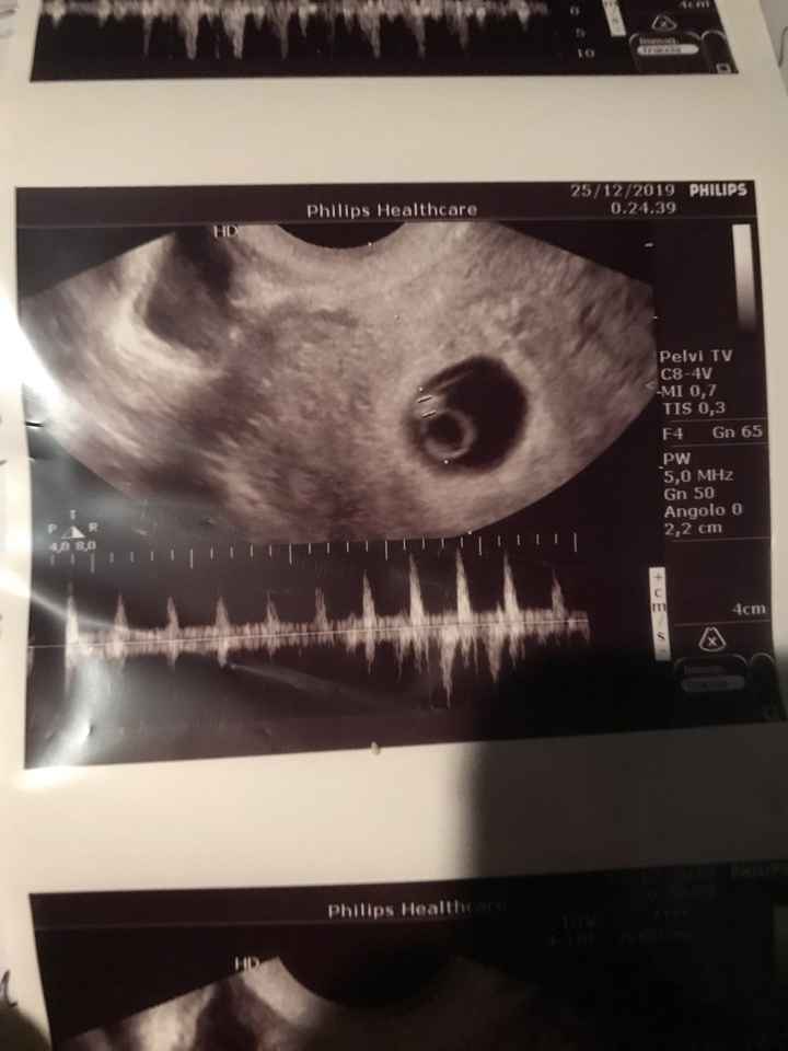 Mamme di Agosto 2020😍🤞😍 - 1