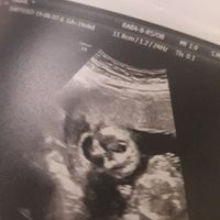 Mamme di Gennaio 2020 ❤️ - 1