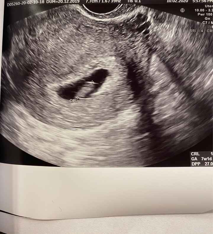 Ecografia, secondo voi come mai è cosi - 1