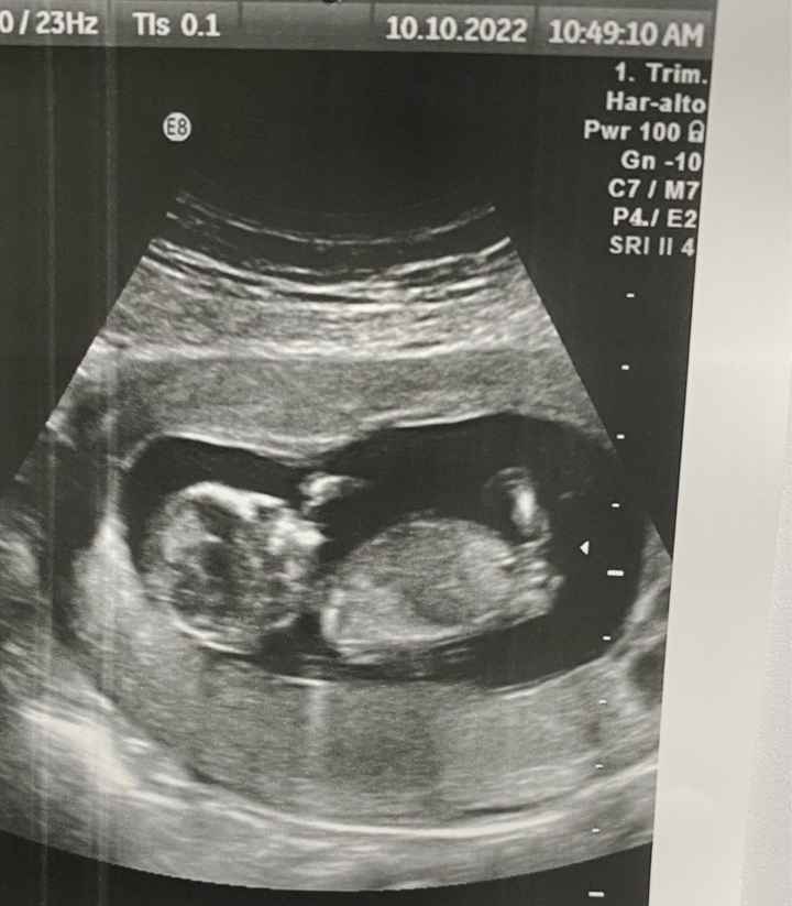 Sondaggio Nub. Maschio o femmina?  🥰 - 1