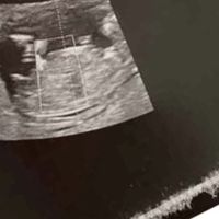 Esperte di Nub Theory?? - 2