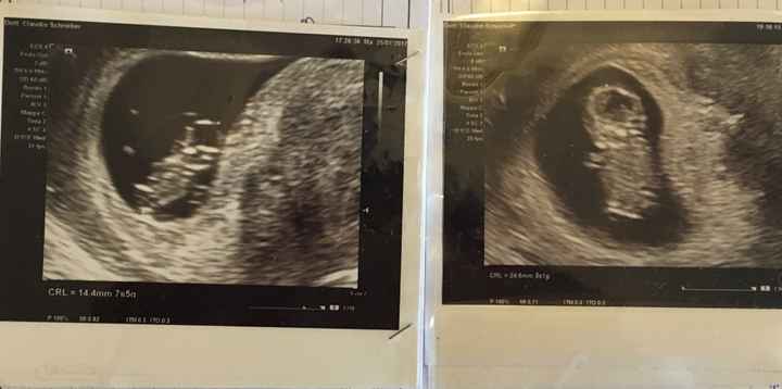 Metodo Ramzi... mi aiutate? 1