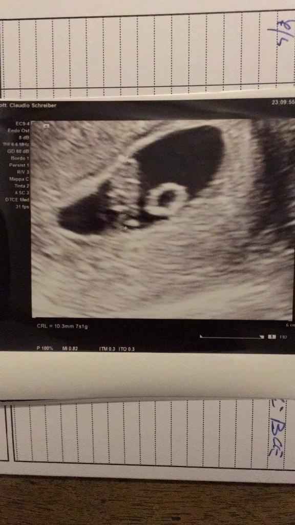 Metodo Ramzi... sfatiamo il mito? 💙 o 💖 1