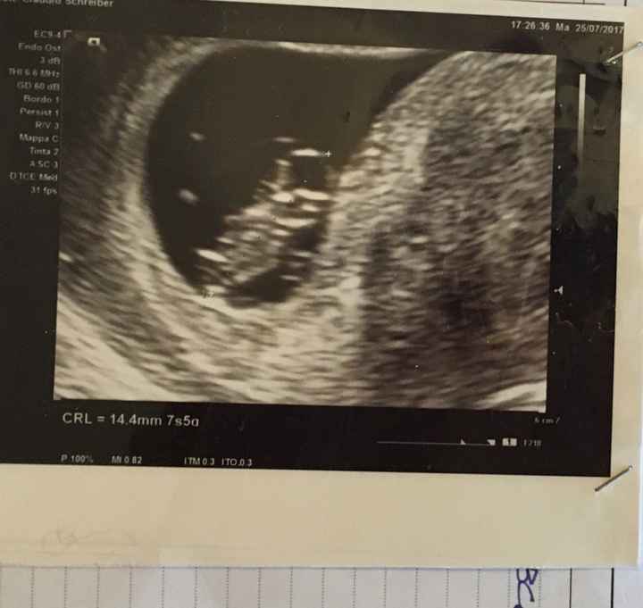 Metodo Ramzi... sfatiamo il mito? 💙 o 💖 2