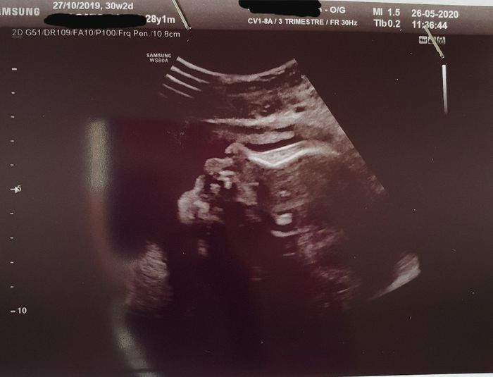 Mamme di Agosto 2020😍🤞😍 3