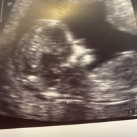 Future mamme Marzo 2021 - 1