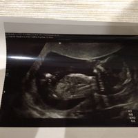 Future mamme ottobre 2020 - 1