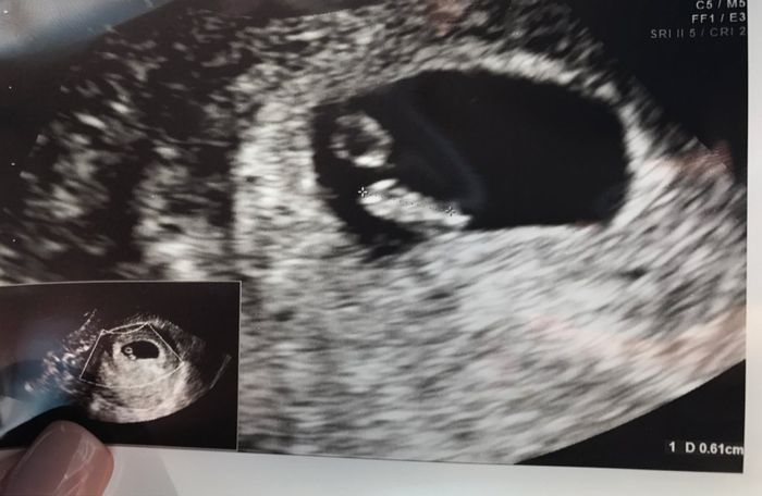 Mamme gennaio 2018 - 1