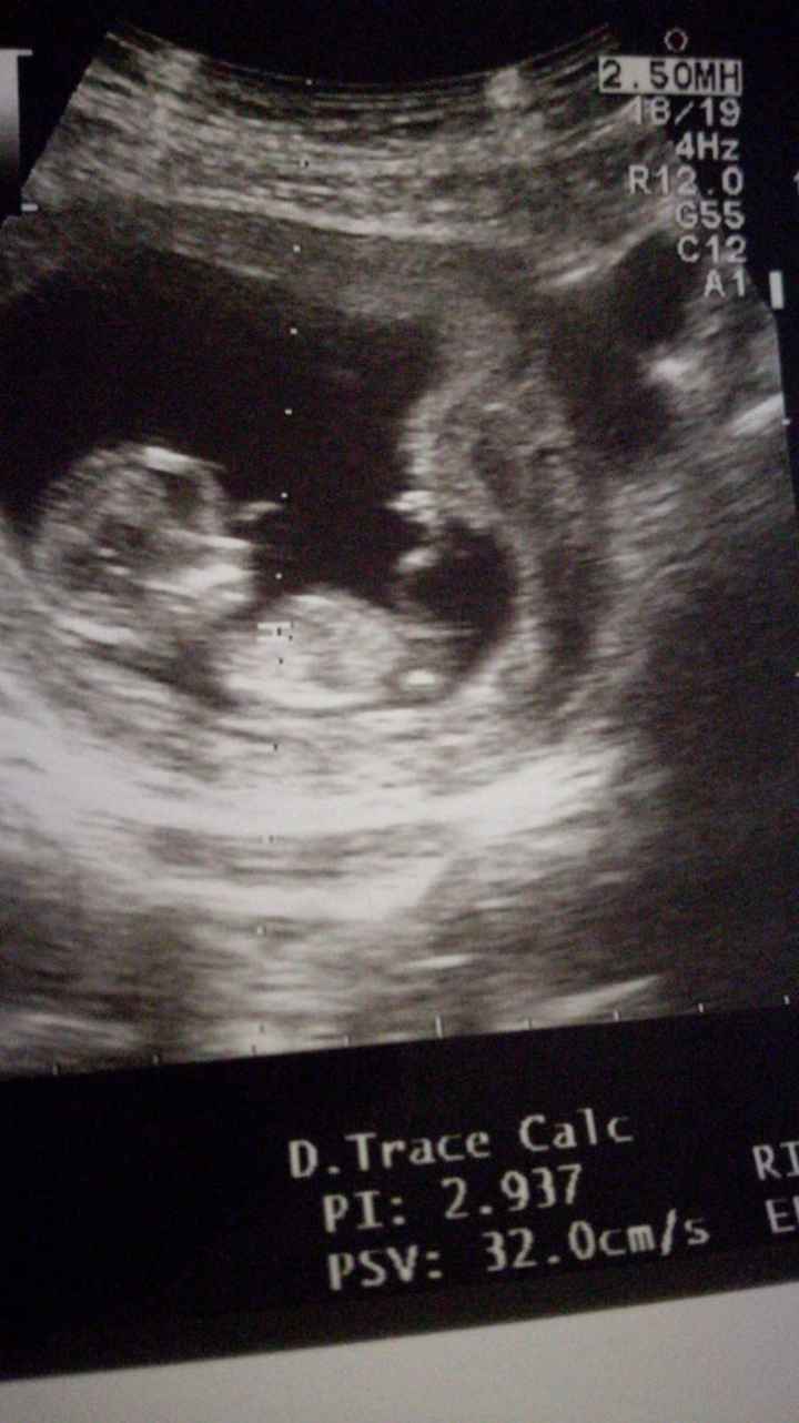 Maschietto o femminuccia in base alla nub theory? - 1